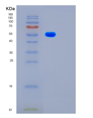 Recombinant Human FSCN1 Protein