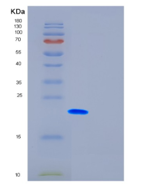 Recombinant Human FTH1 Protein