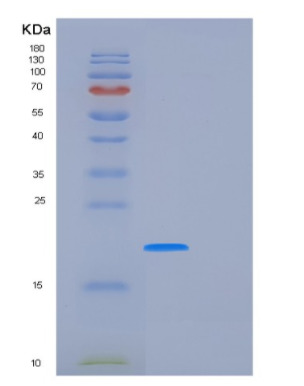 Recombinant Human FUBP1 Protein
