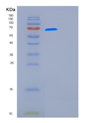 Recombinant Human Furin Protein