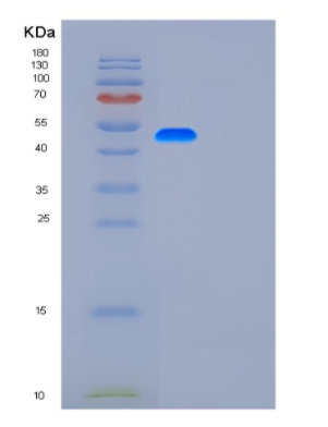 Recombinant Human G3BP1 Protein