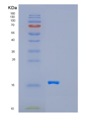 Recombinant Human GABARAP Protein