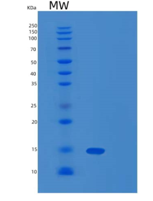Recombinant Human FKBP1a /FKBP12 Protein
