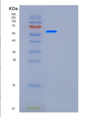 Recombinant Human G6PD Protein