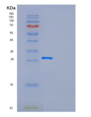 Recombinant Human GAD1 Protein