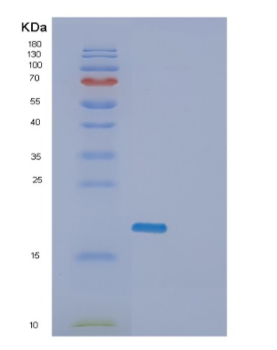 Recombinant Human GADD45A Protein