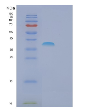 Recombinant Human FSBP Protein