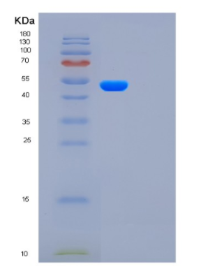 Recombinant Human FUCA2 Protein