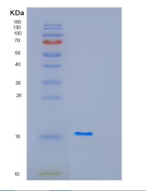Recombinant Human GABARAPL2 Protein