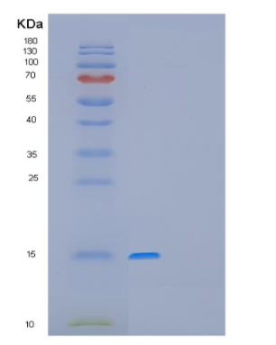 Recombinant Human GAGE12F Protein