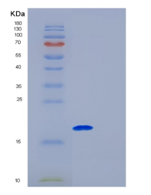 Recombinant Human Galectin9 Protein