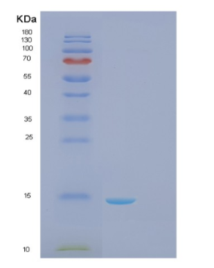 Recombinant Human Galectin-1 Protein