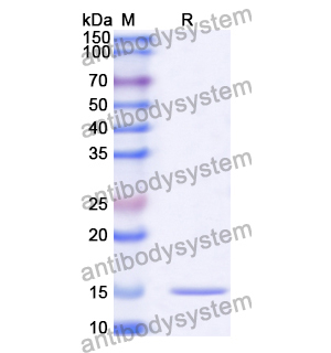 Anti-Human DCX Nanobody (SAA1021)