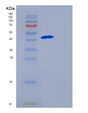 Recombinant Human GALK1 Protein