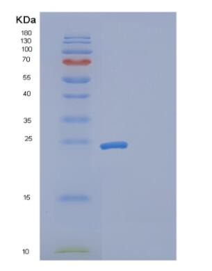 Recombinant Human Gankyrin Protein