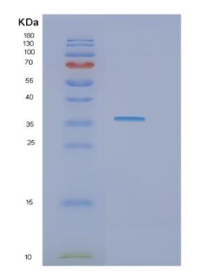 Recombinant Human GAPDH Protein