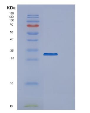Recombinant Human GARS Protein