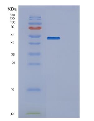 Recombinant Human GAS7 Protein
