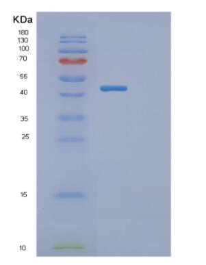 Recombinant Human GATM Protein