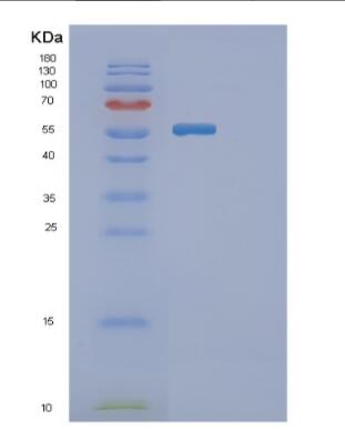 Recombinant Human GBA Protein