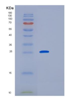 Recombinant Human GCA Protein