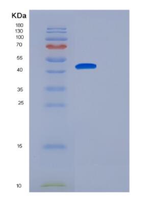 Recombinant Human GCAT Protein