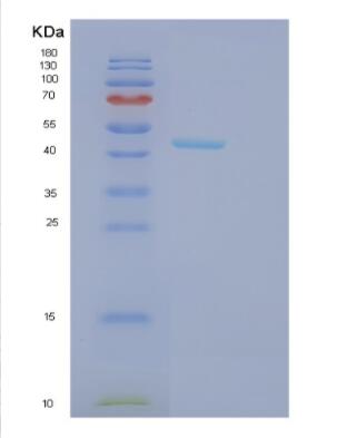 Recombinant Human GCDH Protein