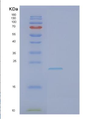 Recombinant Human GCET2 Protein