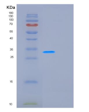 Recombinant Human GCLM Protein