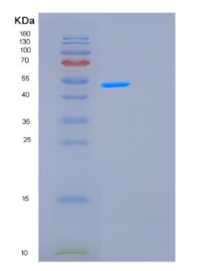 Recombinant Human GCN5L2 Protein