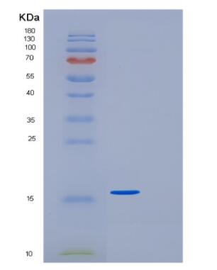 Recombinant Human GDF-15 Protein