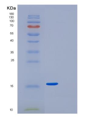 Recombinant Human GDF-5 Protein