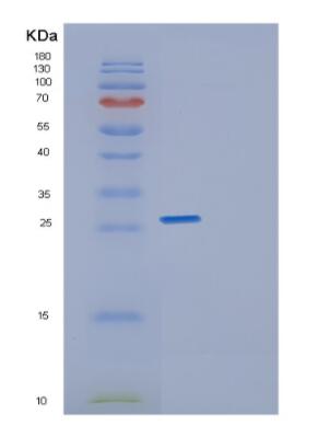 Recombinant Human Geminin Protein