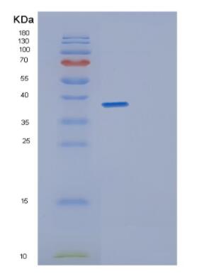 Recombinant Human GET4 Protein