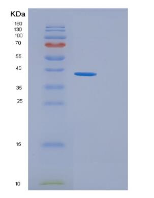 Recombinant Human GGPS1 Protein