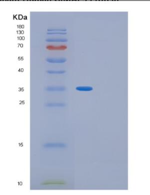 Recombinant Human GIMAP5 Protein