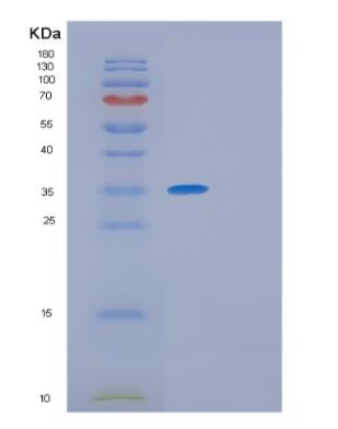 Recombinant Human GIMAP6 Protein