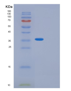 Recombinant Human GIPC2 Protein