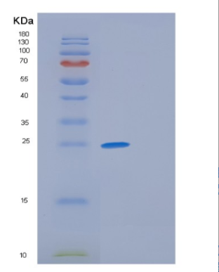 Recombinant Human GKN1 Protein