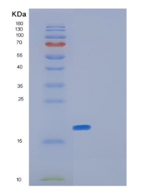 Recombinant Human GLRX5 Protein