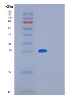 Recombinant Mouse Glutathione S-transferase P 2 Protein