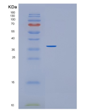 Recombinant Human GLYAT Protein