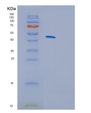 Recombinant Human Glycogen synthase kinase-3 beta Protein