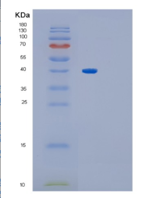 Recombinant Human Glycogenin 1 Protein