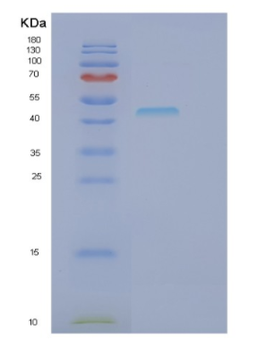 Recombinant Human GNAQ Protein