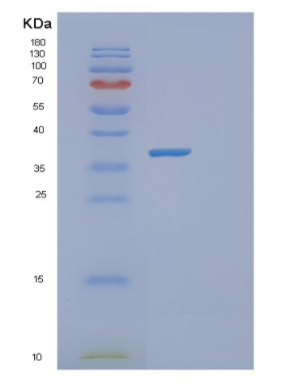 Recombinant Human GNB2L1 Protein