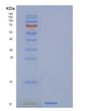 Recombinant Human GNRH1 Protein