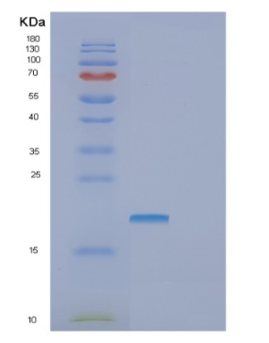 Recombinant Human GOPC Protein