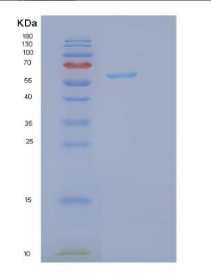 Recombinant Human GPC3 Protein