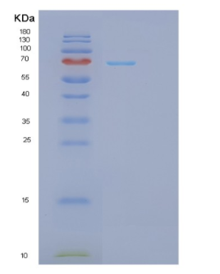 Recombinant Human GPI Protein